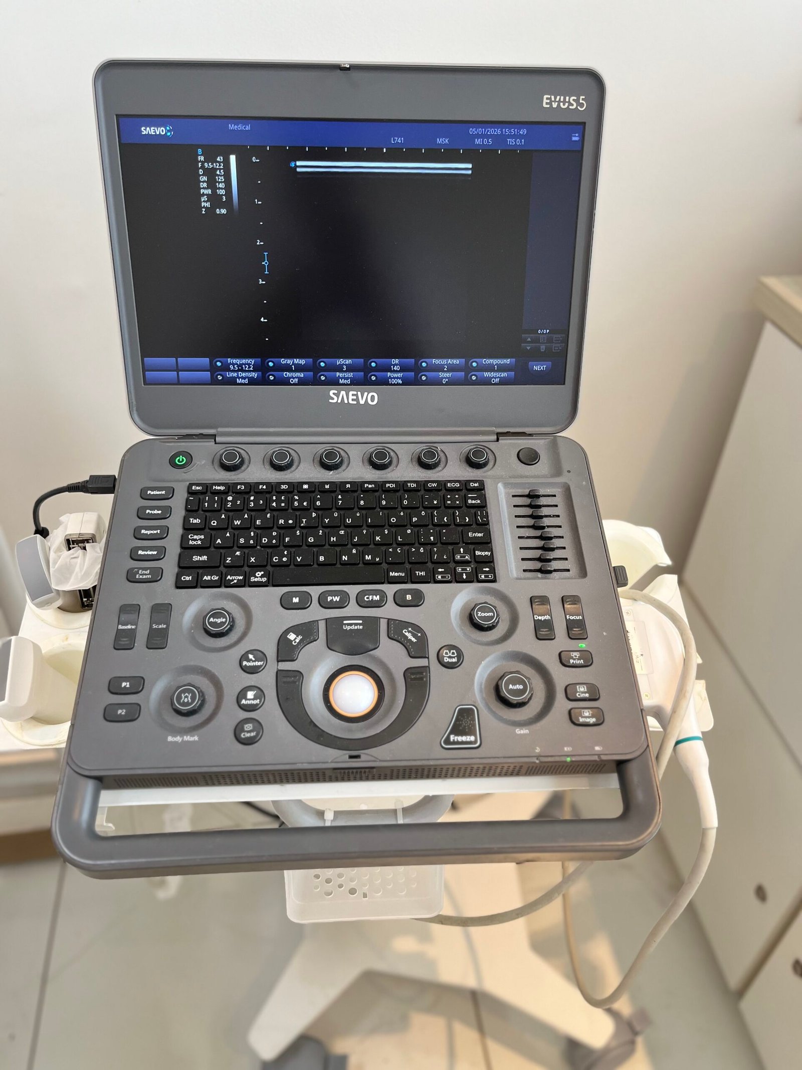 Ultrassom das articulações na consulta ortopédica: como ele pode ajudar no diagnóstico e no tratamento